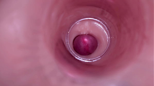 Nymph Insemination wrath-fury Internal Camera Captures Deep Male Ejaculation
